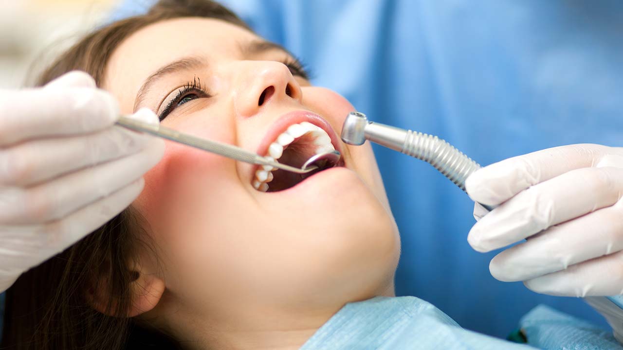 Quante volte lo sbiancamento dentale - Centro Odontoiatrico Oxsana - Dentista Roma - Prenestina